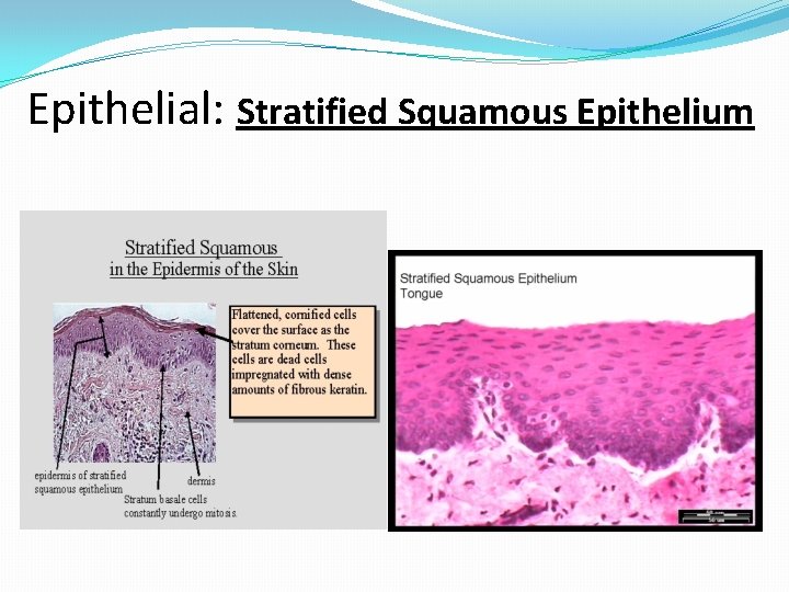 Epithelial: Stratified Squamous Epithelium 