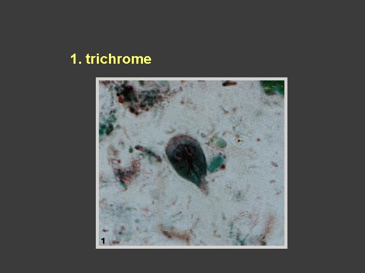1. trichrome 