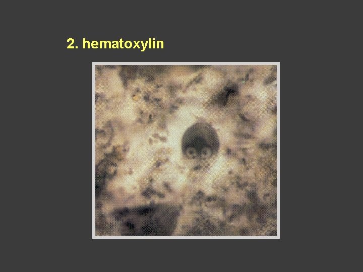 2. hematoxylin 