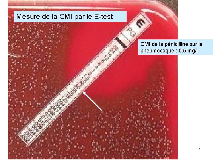 Mesure de la CMI par le E-test CMI de la pénicilline sur le pneumocoque