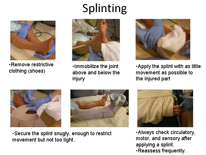 Splinting • Remove restrictive clothing (shoes) • Immobilize the joint above and below the