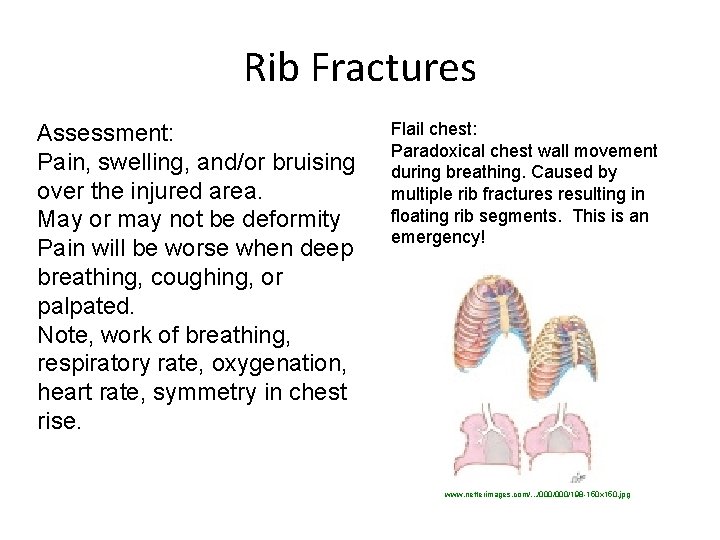 Rib Fractures Assessment: Pain, swelling, and/or bruising over the injured area. May or may