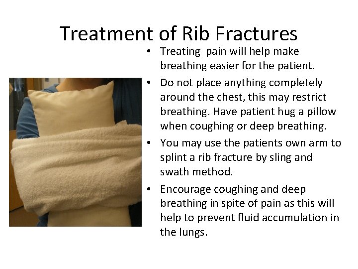 Treatment of Rib Fractures • Treating pain will help make breathing easier for the