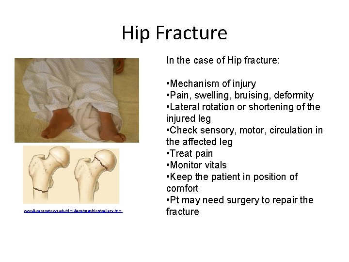 Hip Fracture In the case of Hip fracture: www 8. georgetown. edu/dml/facs/graphics/gallery. htm •