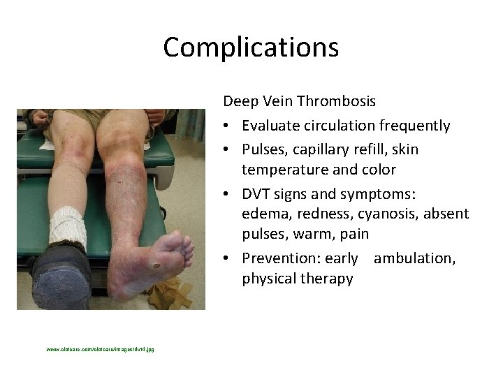 Complications Deep Vein Thrombosis • Evaluate circulation frequently • Pulses, capillary refill, skin temperature