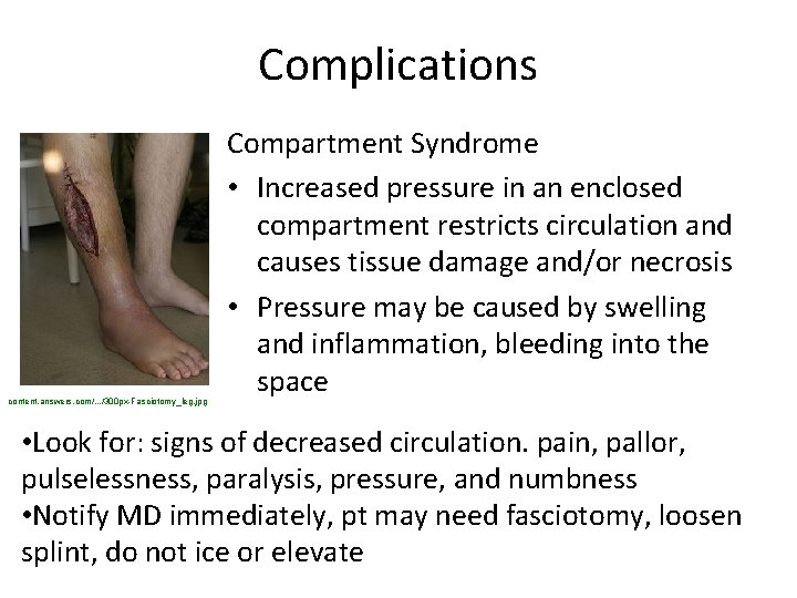 Complications content. answers. com/. . . /300 px-Fasciotomy_leg. jpg Compartment Syndrome • Increased pressure