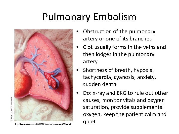 Pulmonary Embolism http: //jaapa. com/issues/j 20060701/screen/pulmonary 0706 art. gif • Obstruction of the pulmonary