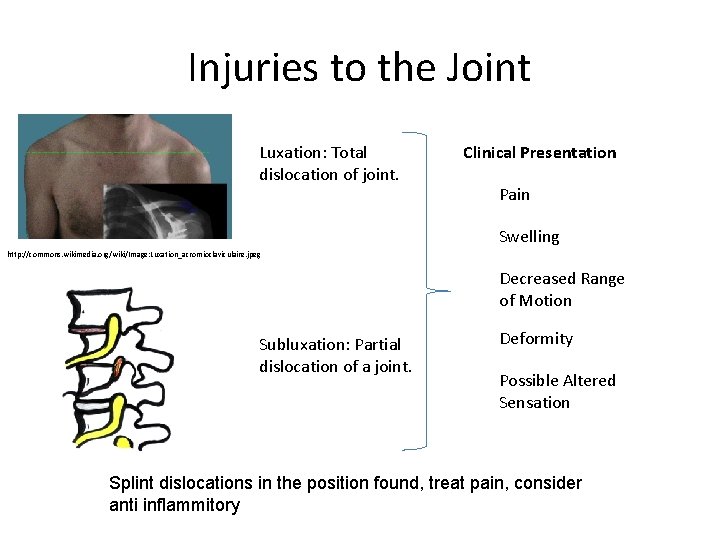 Injuries to the Joint Luxation: Total dislocation of joint. Clinical Presentation Pain Swelling http:
