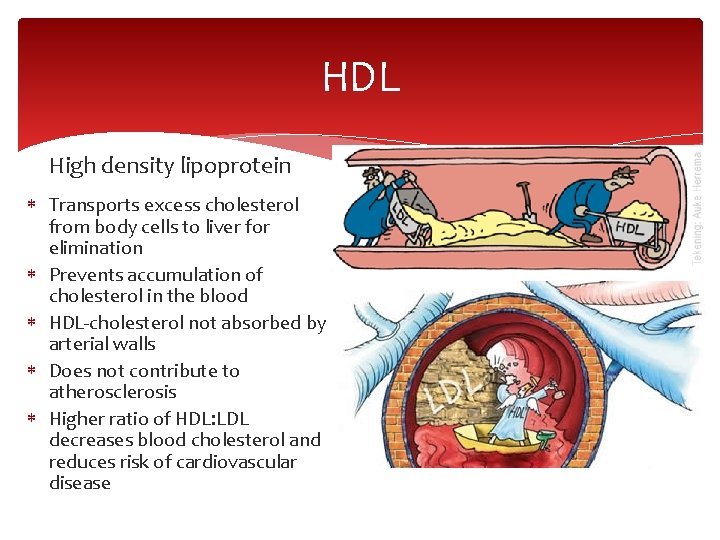 HDL High density lipoprotein Transports excess cholesterol from body cells to liver for elimination