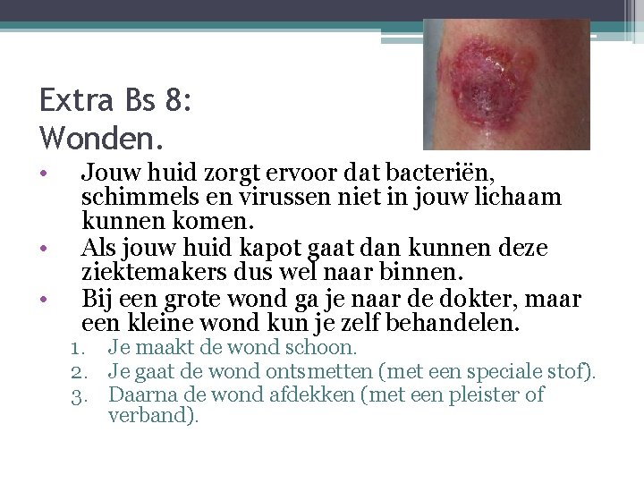 Extra Bs 8: Wonden. • • • Jouw huid zorgt ervoor dat bacteriën, schimmels