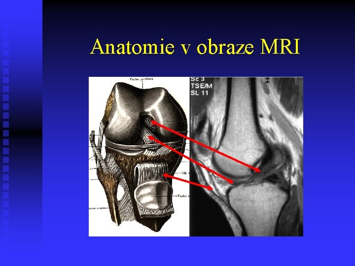 Anatomie v obraze MRI 