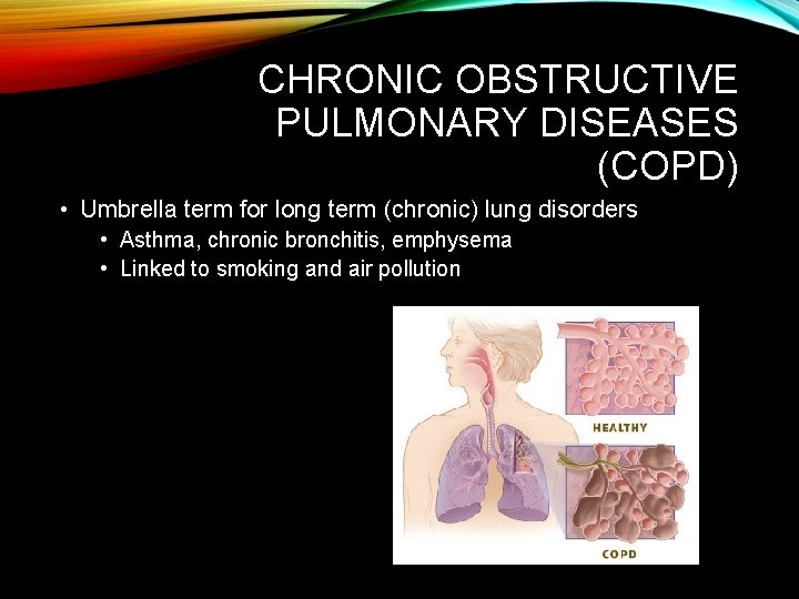 CHRONIC OBSTRUCTIVE PULMONARY DISEASES (COPD) • Umbrella term for long term (chronic) lung disorders