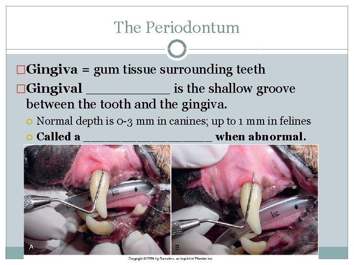 The Periodontum �Gingiva = gum tissue surrounding teeth �Gingival _____ is the shallow groove