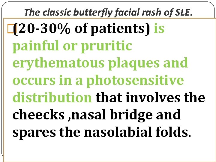 The classic butterfly facial rash of SLE. �(20 -30% of patients) is painful or