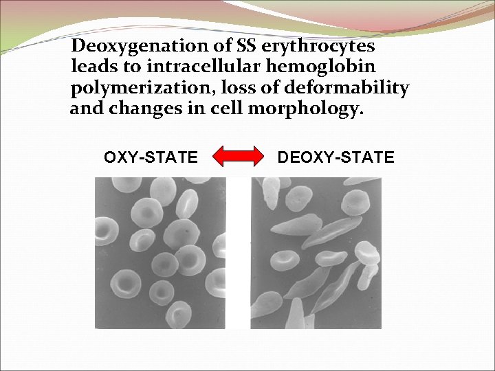 Deoxygenation of SS erythrocytes leads to intracellular hemoglobin polymerization, loss of deformability and changes