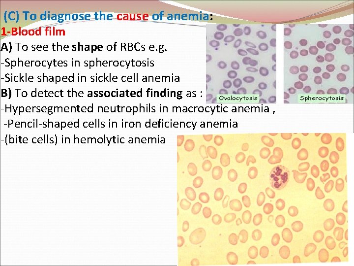 (C) To diagnose the cause of anemia: 1 -Blood film A) To see the