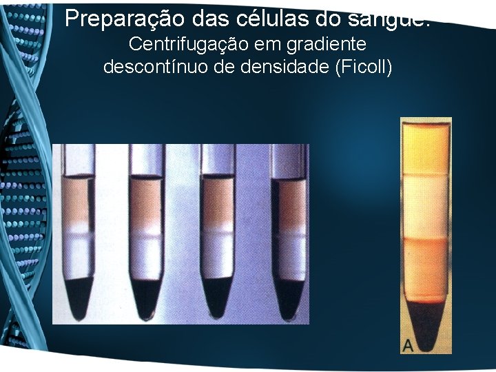 Preparação das células do sangue: Centrifugação em gradiente descontínuo de densidade (Ficoll) 