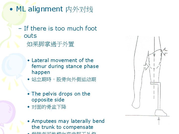  • ML alignment 内外对线 – If there is too much foot outs 如果脚掌過于外置
