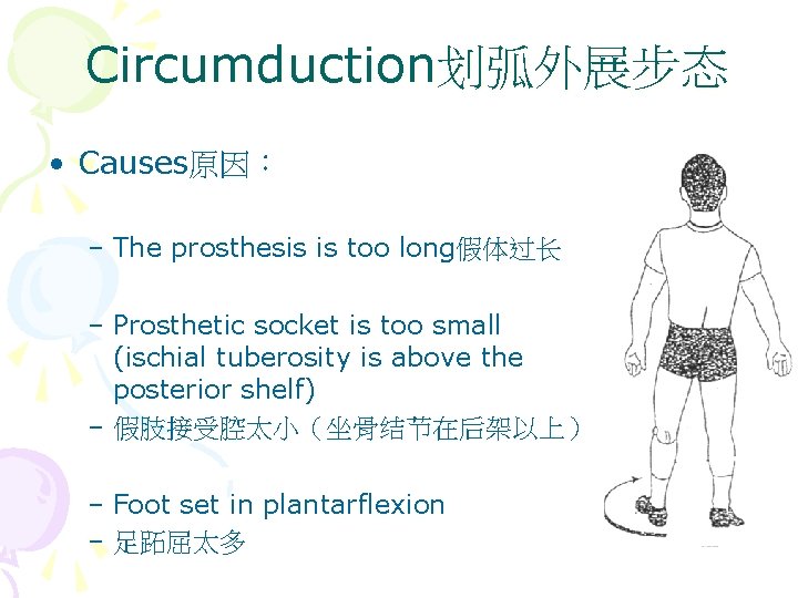 Circumduction划弧外展步态 • Causes原因： – The prosthesis is too long假体过长 – Prosthetic socket is too