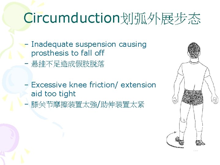 Circumduction划弧外展步态 – Inadequate suspension causing prosthesis to fall off – 悬挂不足造成假肢脱落 – Excessive knee