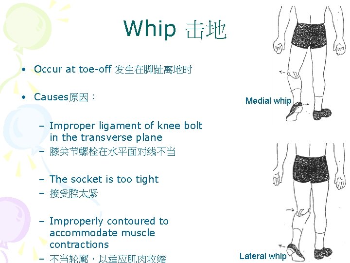 Whip 击地 • Occur at toe-off 发生在脚趾离地时 • Causes原因： Medial whip – Improper ligament