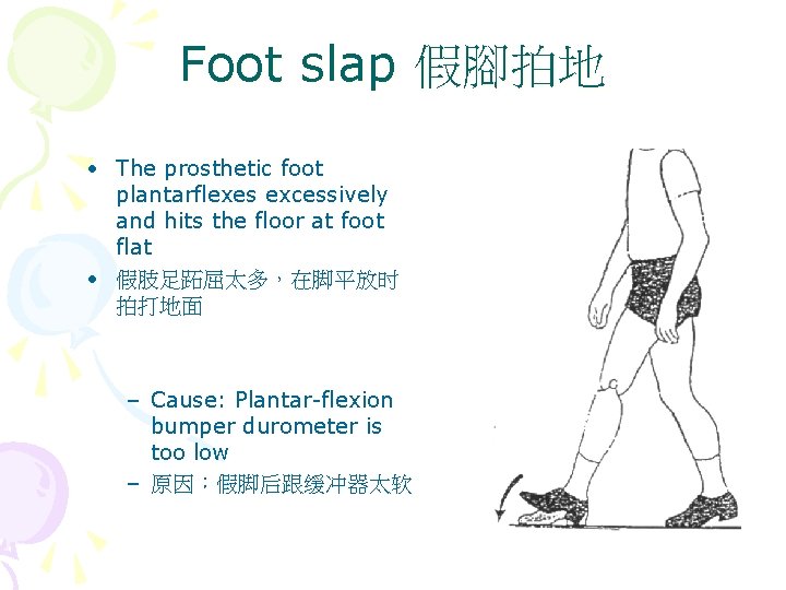 Foot slap 假腳拍地 • The prosthetic foot plantarflexes excessively and hits the floor at