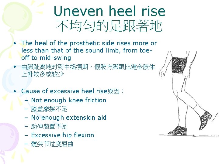 Uneven heel rise 不均匀的足跟著地 • The heel of the prosthetic side rises more or