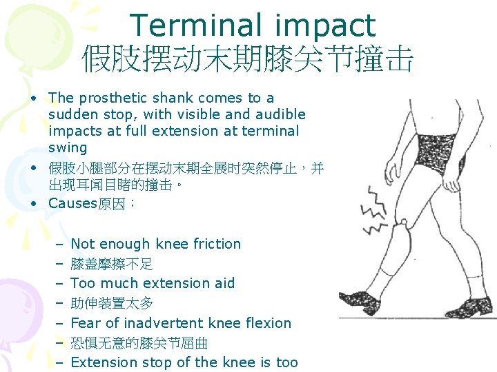 Terminal impact 假肢摆动末期膝关节撞击 • The prosthetic shank comes to a sudden stop, with visible