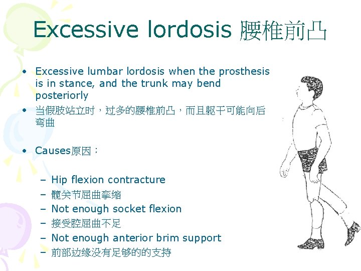 Excessive lordosis 腰椎前凸 • Excessive lumbar lordosis when the prosthesis is in stance, and