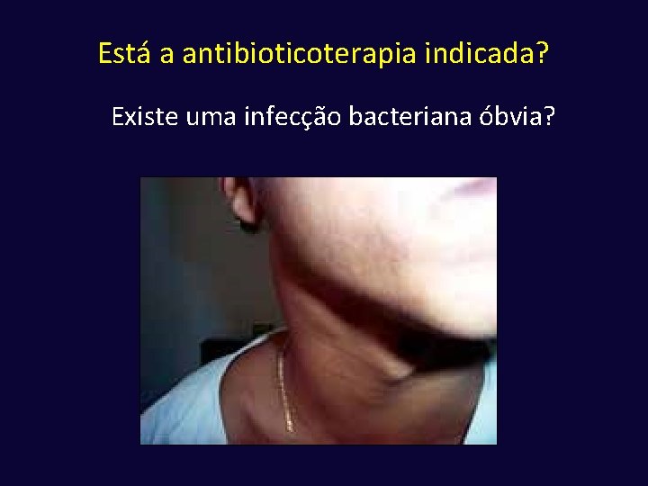 Está a antibioticoterapia indicada? Existe uma infecção bacteriana óbvia? 