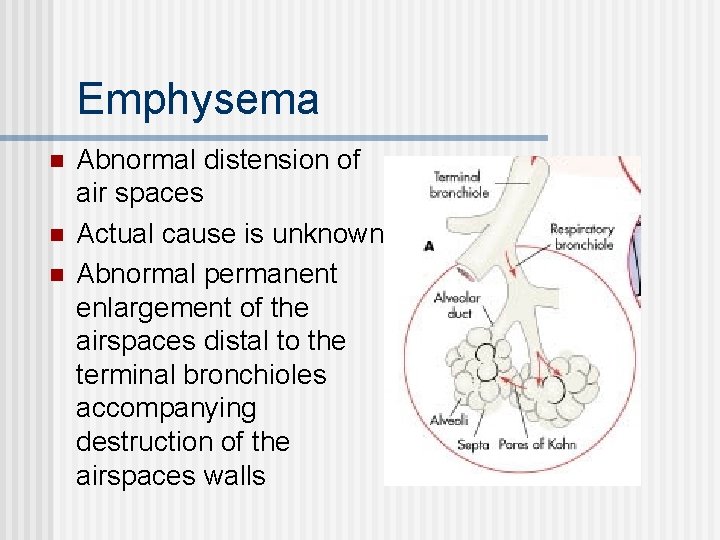 Emphysema n n n Abnormal distension of air spaces Actual cause is unknown Abnormal