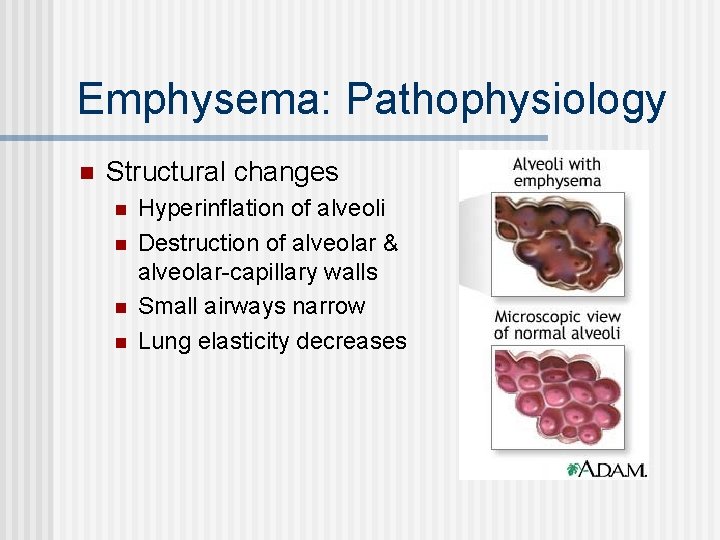 Emphysema: Pathophysiology n Structural changes n n Hyperinflation of alveoli Destruction of alveolar &