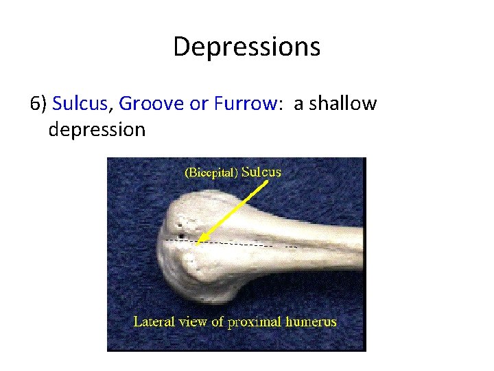 Depressions 6) Sulcus, Groove or Furrow: a shallow depression Depressions 6) Sulcus, Groove or Furrow: a shallow depression