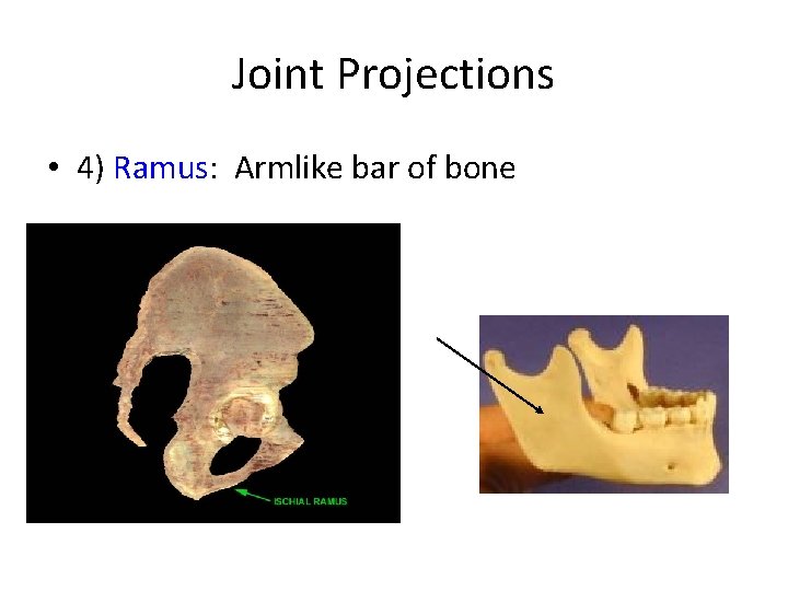 Joint Projections • 4) Ramus: Armlike bar of bone Joint Projections • 4) Ramus: Armlike bar of bone