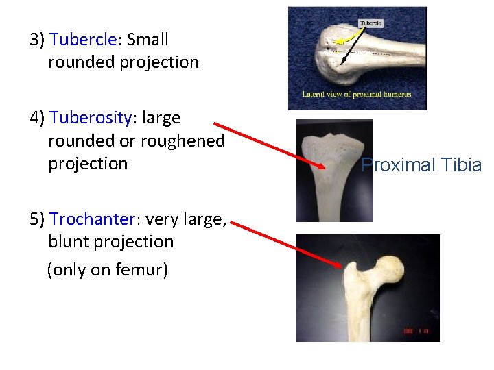 3) Tubercle: Small rounded projection 4) Tuberosity: large rounded or roughened projection 5) Trochanter: 3) Tubercle: Small rounded projection 4) Tuberosity: large rounded or roughened projection 5) Trochanter: