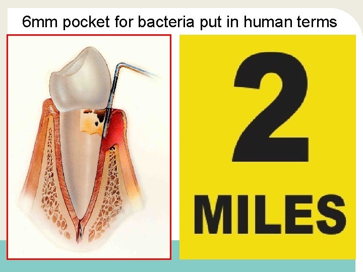 6 mm pocket for bacteria put in human terms 