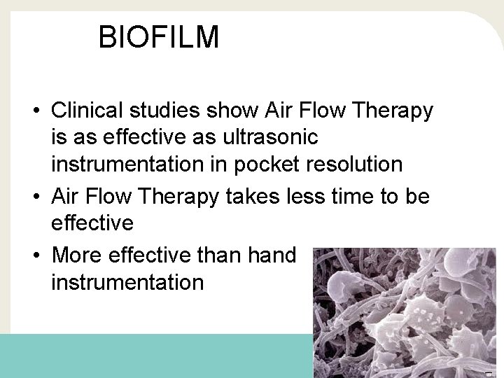 BIOFILM • Clinical studies show Air Flow Therapy is as effective as ultrasonic instrumentation