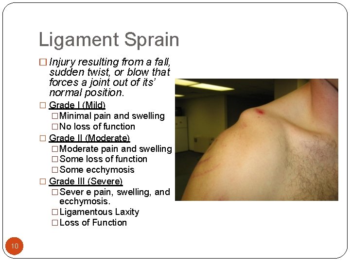 Ligament Sprain � Injury resulting from a fall, sudden twist, or blow that forces