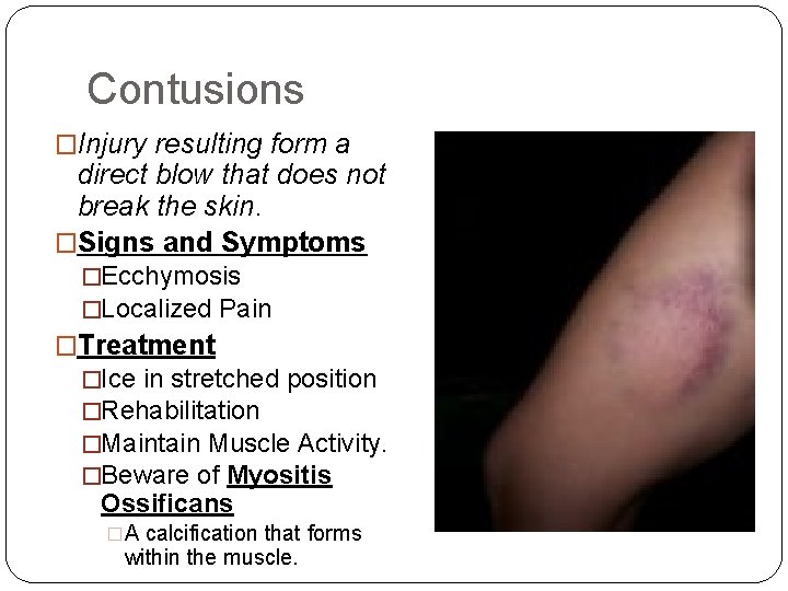 Contusions �Injury resulting form a direct blow that does not break the skin. �Signs