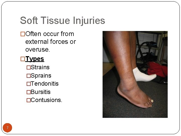 Soft Tissue Injuries �Often occur from external forces or overuse. �Types �Strains �Sprains �Tendonitis