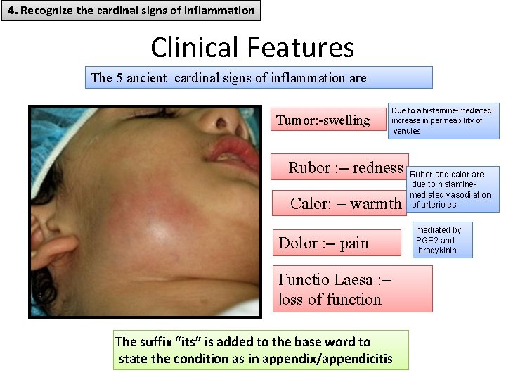4. Recognize the cardinal signs of inflammation Clinical Features The 5 ancient cardinal signs