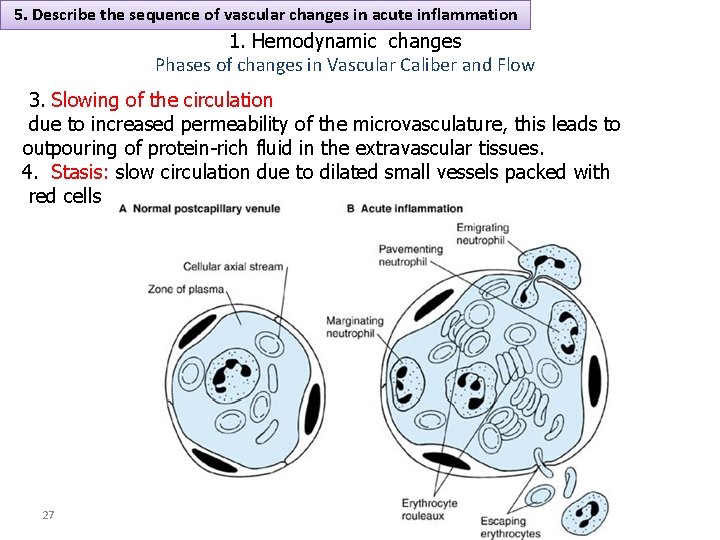 5. Describe the sequence of vascular changes in acute inflammation 1. Hemodynamic changes Phases