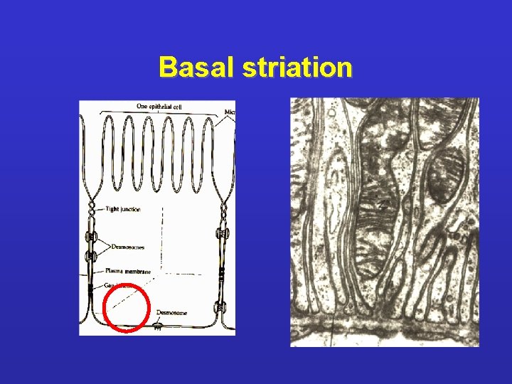 Basal striation 