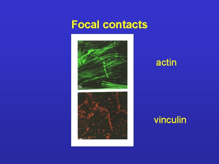 Focal contacts actin vinculin 