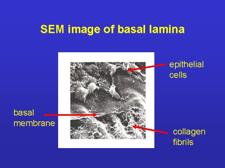 SEM image of basal lamina epithelial cells basal membrane collagen fibrils 
