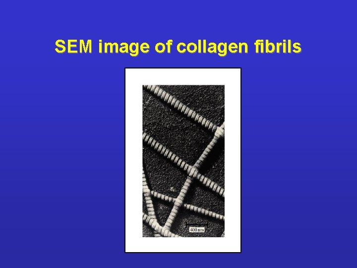 SEM image of collagen fibrils 