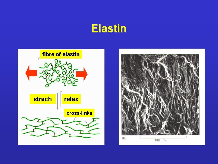 Elastin fibre of elastin strech relax cross-links 