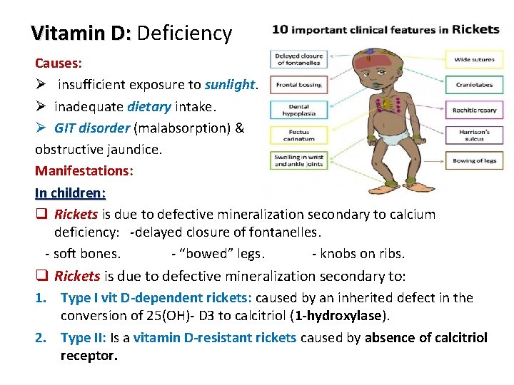 Vitamin D: Deficiency Causes: Ø insufficient exposure to sunlight. Ø inadequate dietary intake. Ø