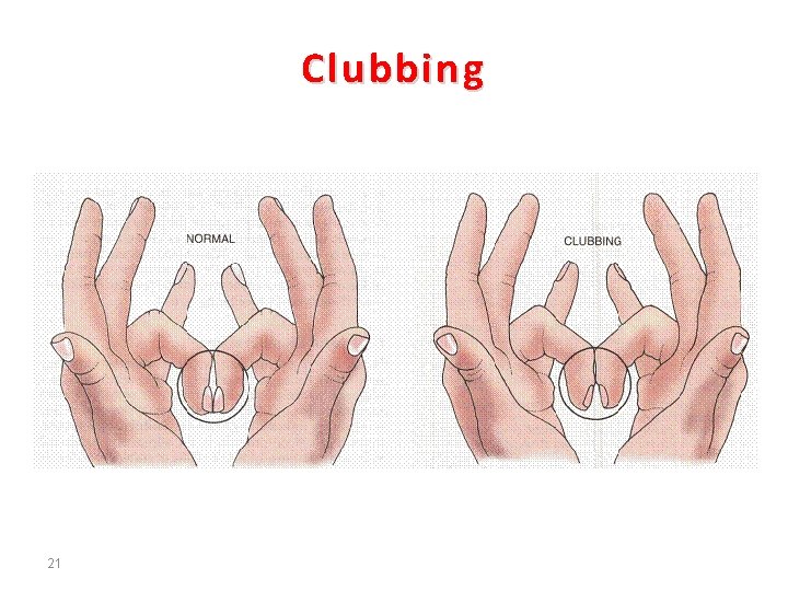 Clubbing 21 