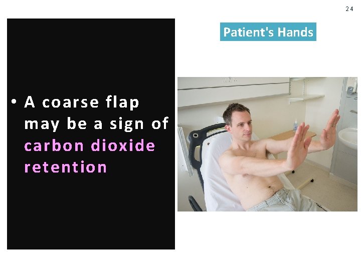 24 Patient's Hands • A coarse flap may be a sign of carbon dioxide